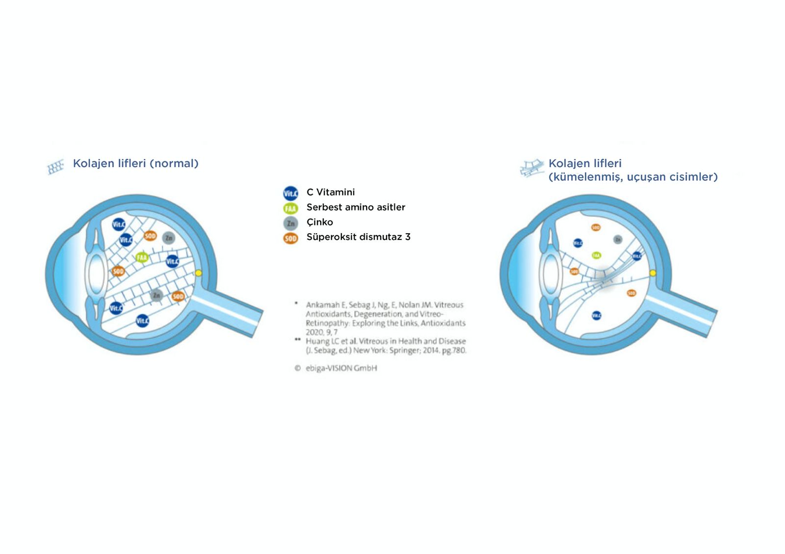Göz uçuşmaları tedavi edilebilir mi? - Vitreus vücudundaki kümelenmiş ve normal lifleri ve mikrobesinlerin rolünü gösteren şematik görüntü