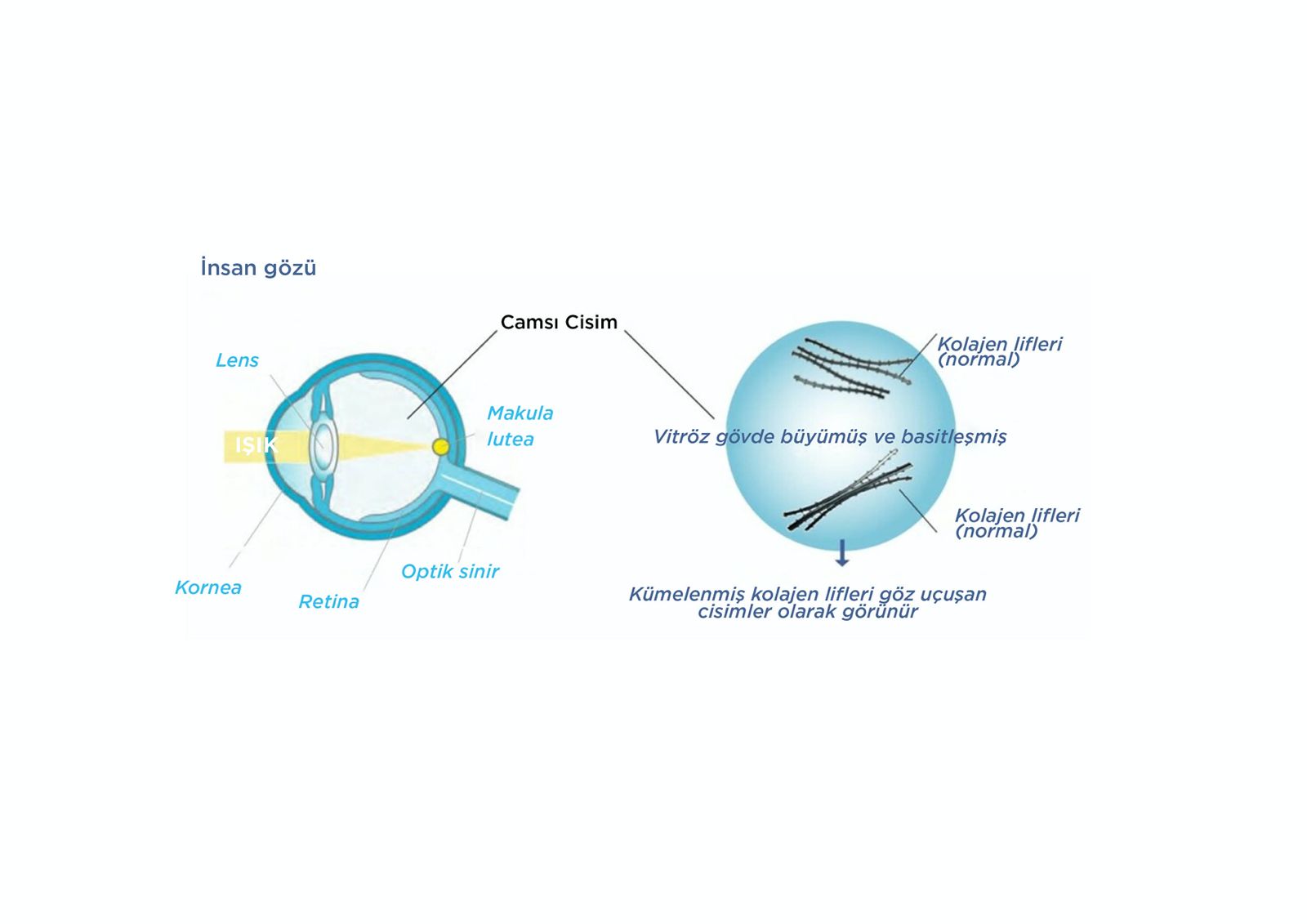Gözde Uçuşan Cisimler Bitkisel Tedavisi - entoptik görüntüler açıklaması